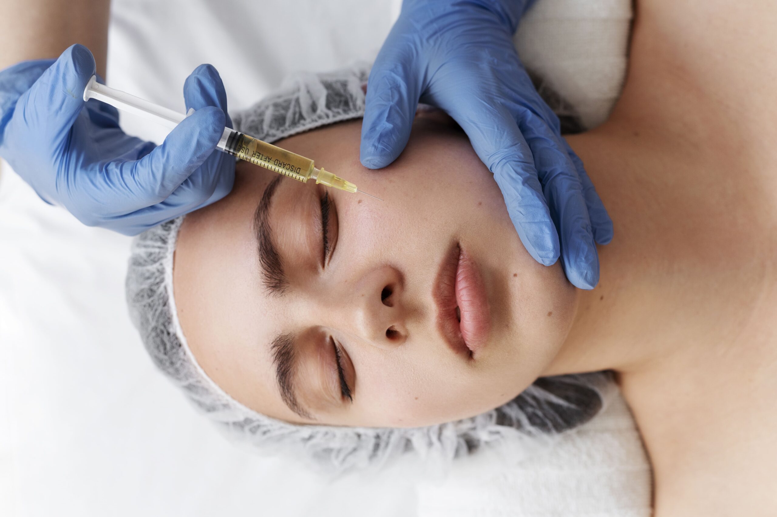 top-view-woman-getting-face-prp-treatment (1)